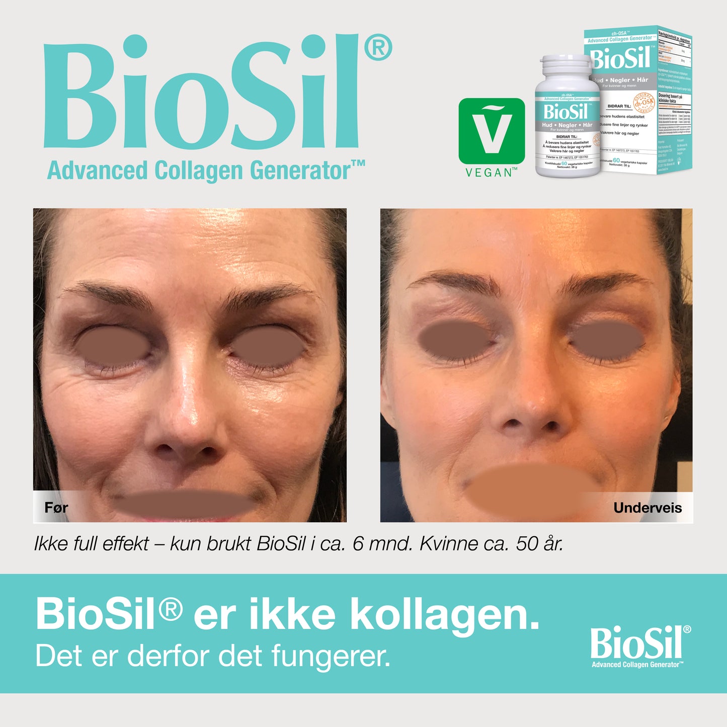 BioSil® – Advanced Collagen Generator, 60 kapsler