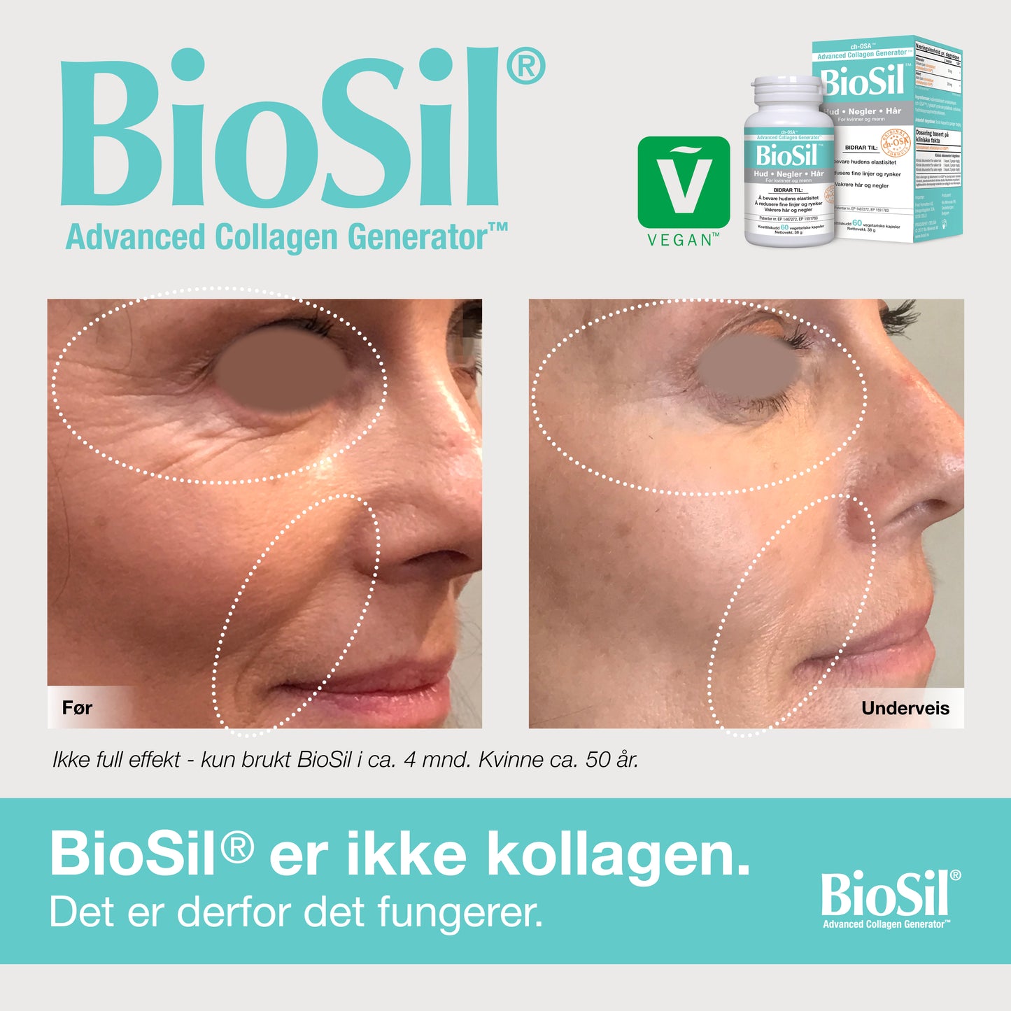 BioSil® – Advanced Collagen Generator, 60 kapsler
