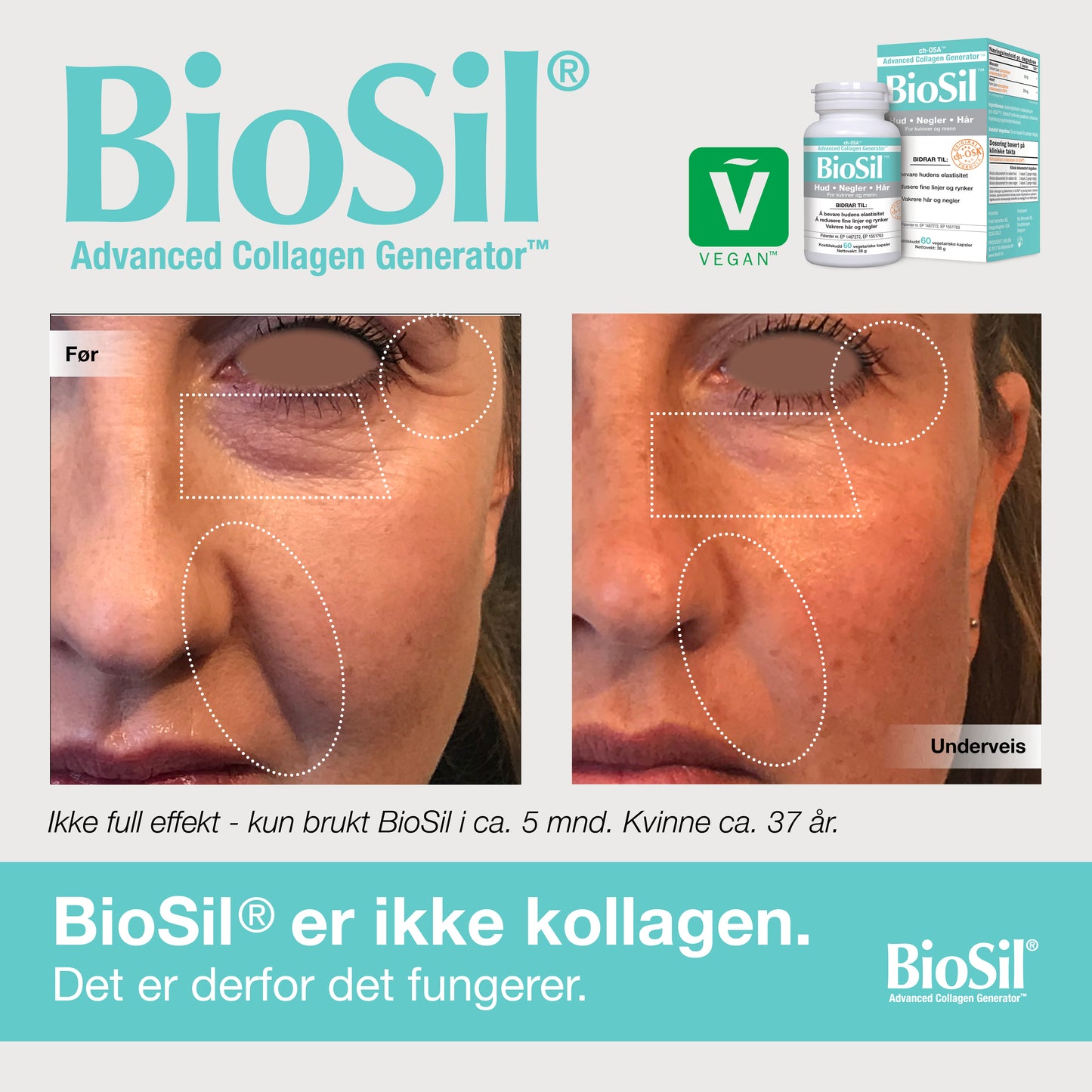 BioSil® – Advanced Collagen Generator, 60 kapsler