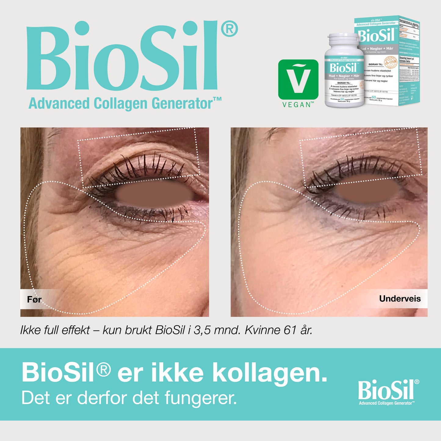 BioSil® – Advanced Collagen Generator, 60 kapsler
