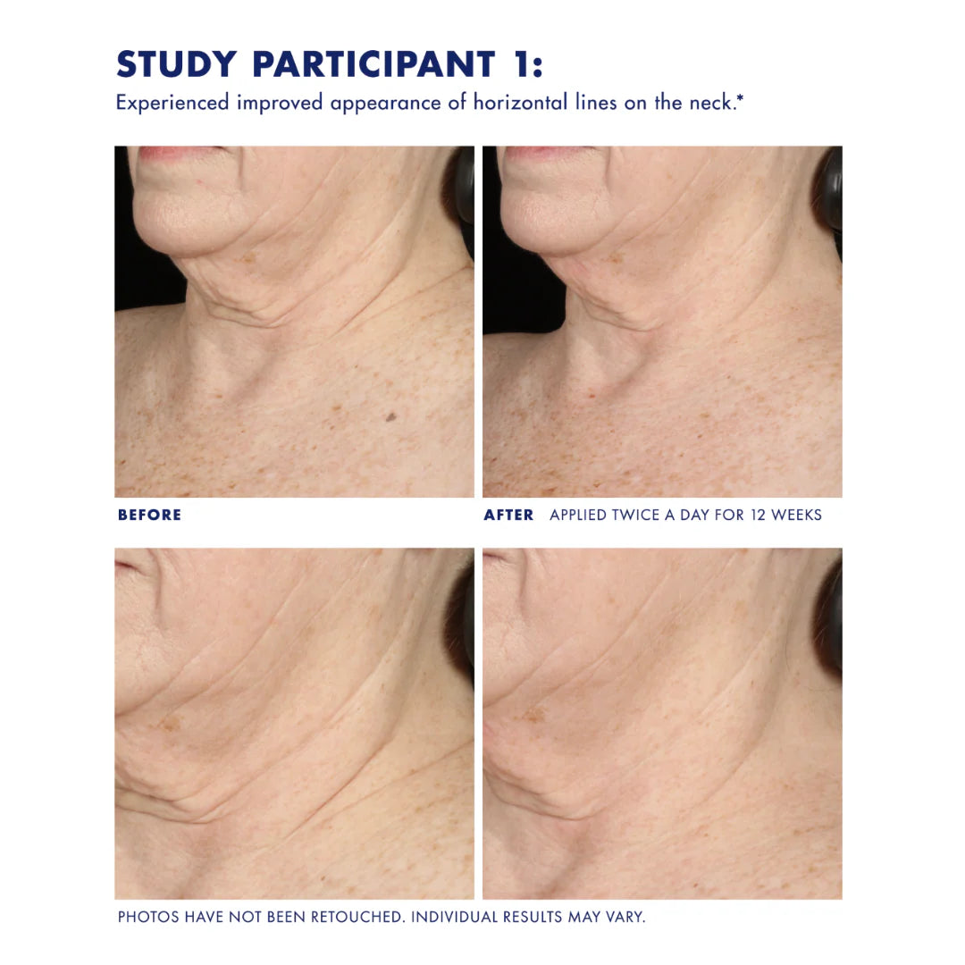 Obagi Neck and Décolleté Concentrate 60ml