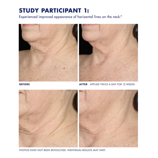 Obagi Neck and Décolleté Concentrate 60ml